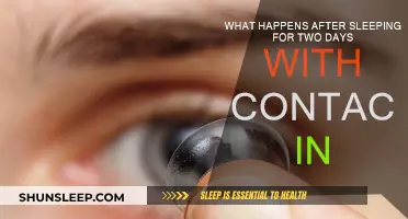 The Dangers of Sleeping with Contacts: A Wake-Up Call