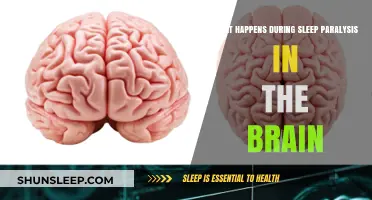 Brain Activity During Sleep Paralysis Explained