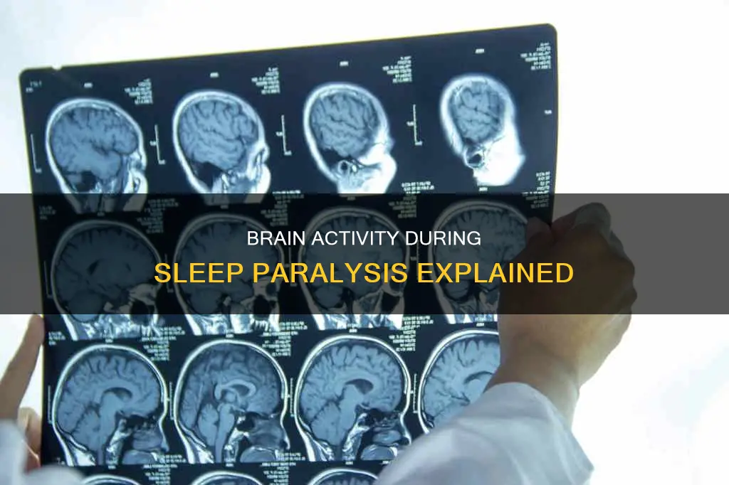 what happens during sleep paralysis in the brain