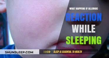 Allergic Reactions in Sleep: What You Need to Know