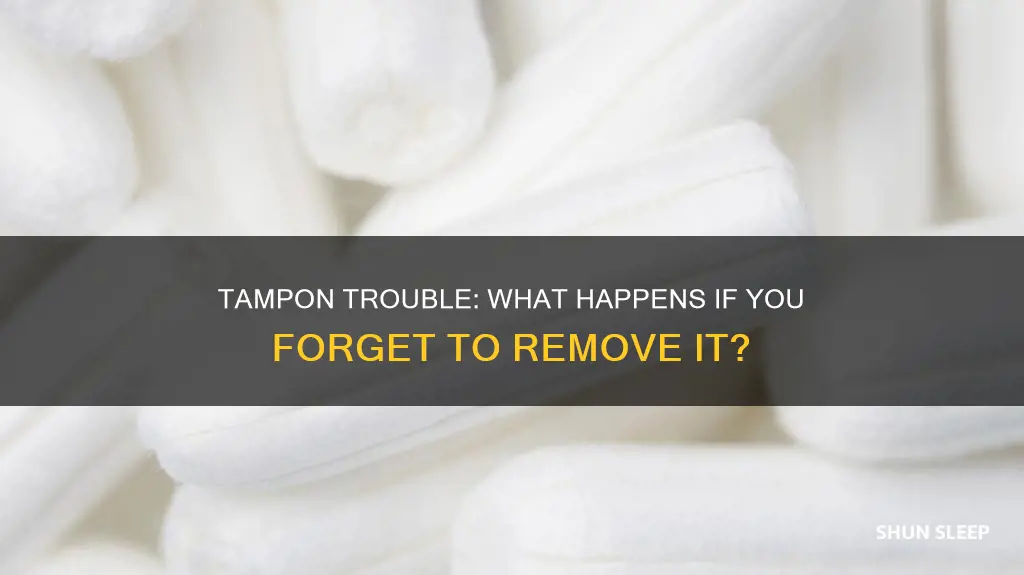 what happens if i accidentally sleep with a tampoj in
