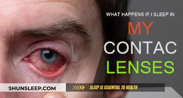 Sleeping with Contact Lenses: Risks and Complications