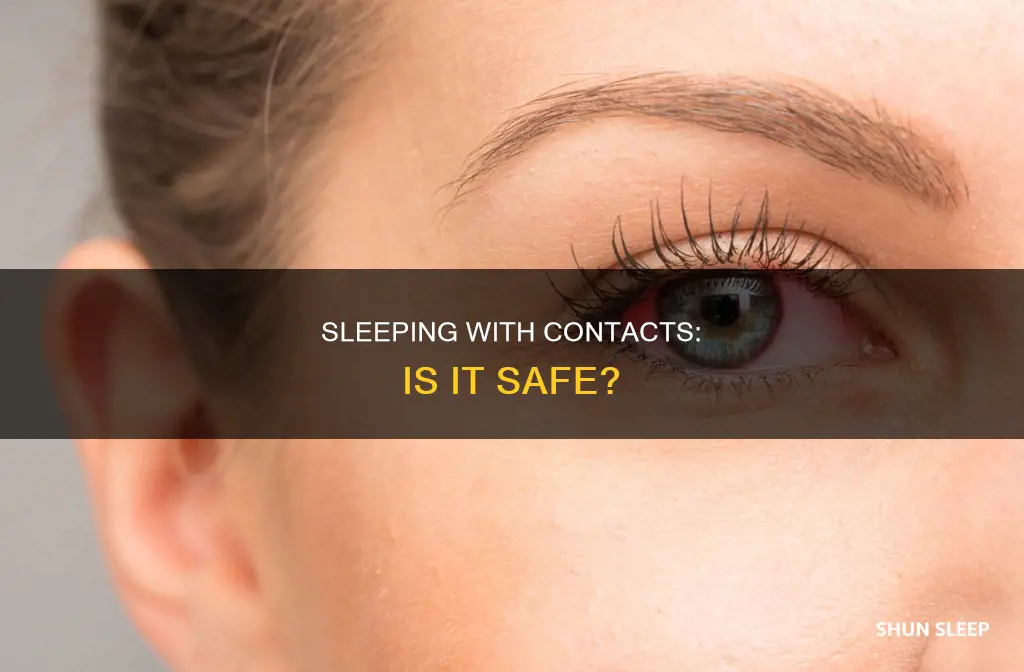 what happens if i sleep with eye contacts