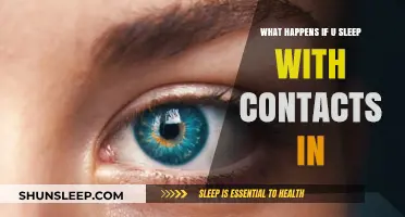 Sleeping with Contacts: A Dangerous Risk