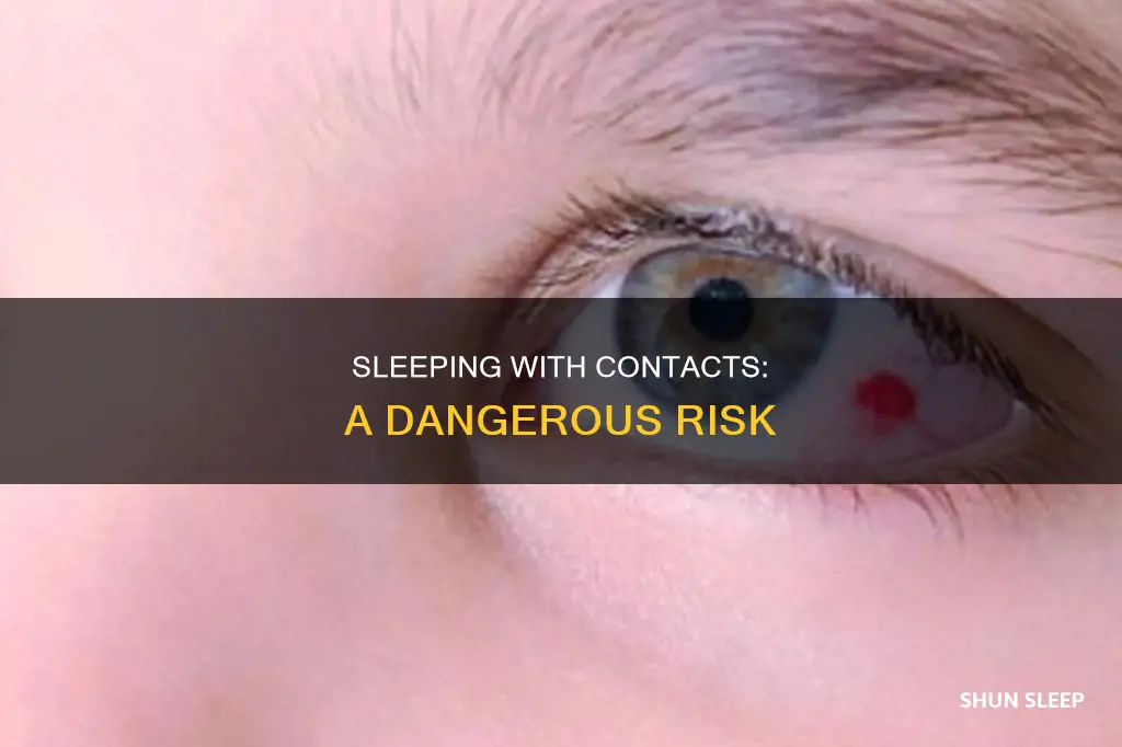 what happens if u sleep with contacts in