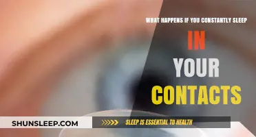 Sleeping in Contacts: Risky Business for Your Eyes