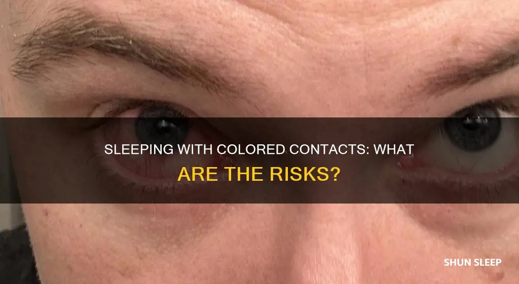 what happens if you fall sleep with colored contacts in
