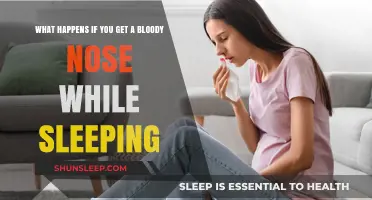 Waking Up with a Nosebleed: Causes, Risks, and Remedies