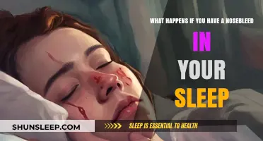 Nosebleeds in Sleep: What You Need to Know