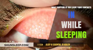 Sleeping with Contacts: Risks and Dangers