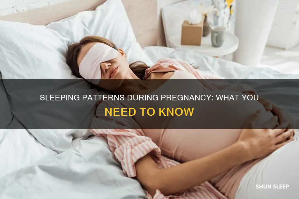 what happens if you sleep alot when pregnant