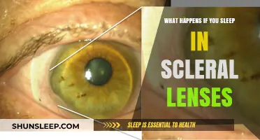 Sleeping in Scleral Lenses: Risks and Recommendations