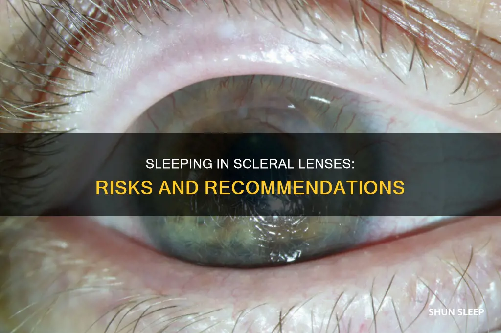 what happens if you sleep in scleral lenses