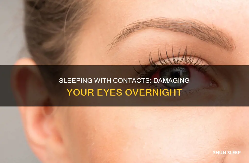 what happens if you sleep overnight with contacts