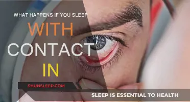 Sleeping with Contacts: A Dangerous Risk