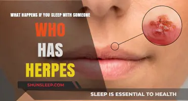 Herpes and Sleep: What Are the Risks?