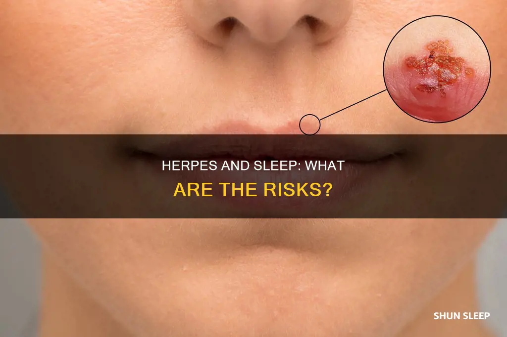 what happens if you sleep with someone who has herpes