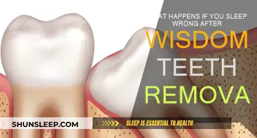 Wisdom Teeth Removal: Sleep Wrong, Face Swells