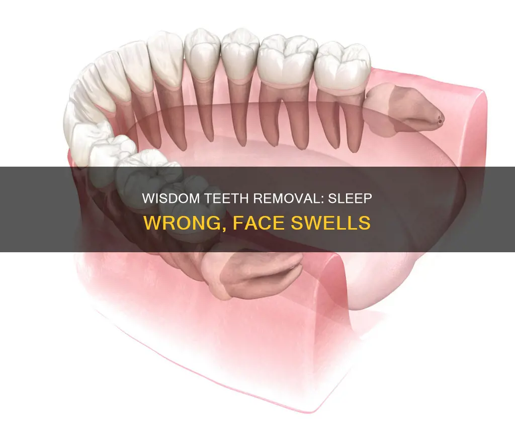 what happens if you sleep wrong after wisdom teeth removal