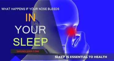 Nosebleeds in Sleep: What You Need to Know