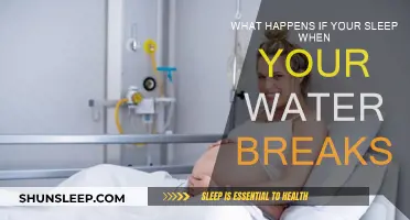 When Water Breaks, Should You Sleep or Rush to the Hospital?