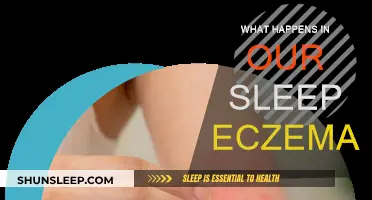 Eczema and Sleep: What's the Connection?