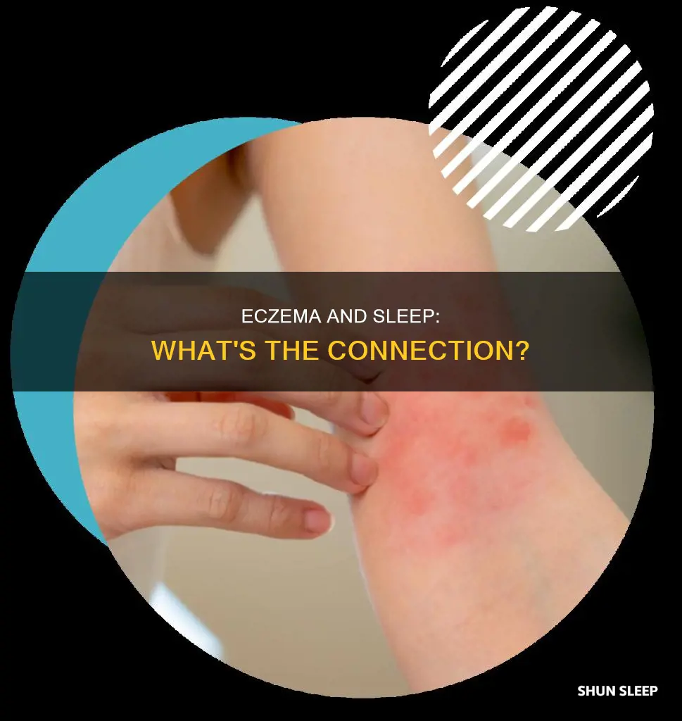 what happens in our sleep eczema
