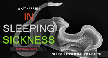 The Mystery of Sleeping Sickness: What You Need to Know