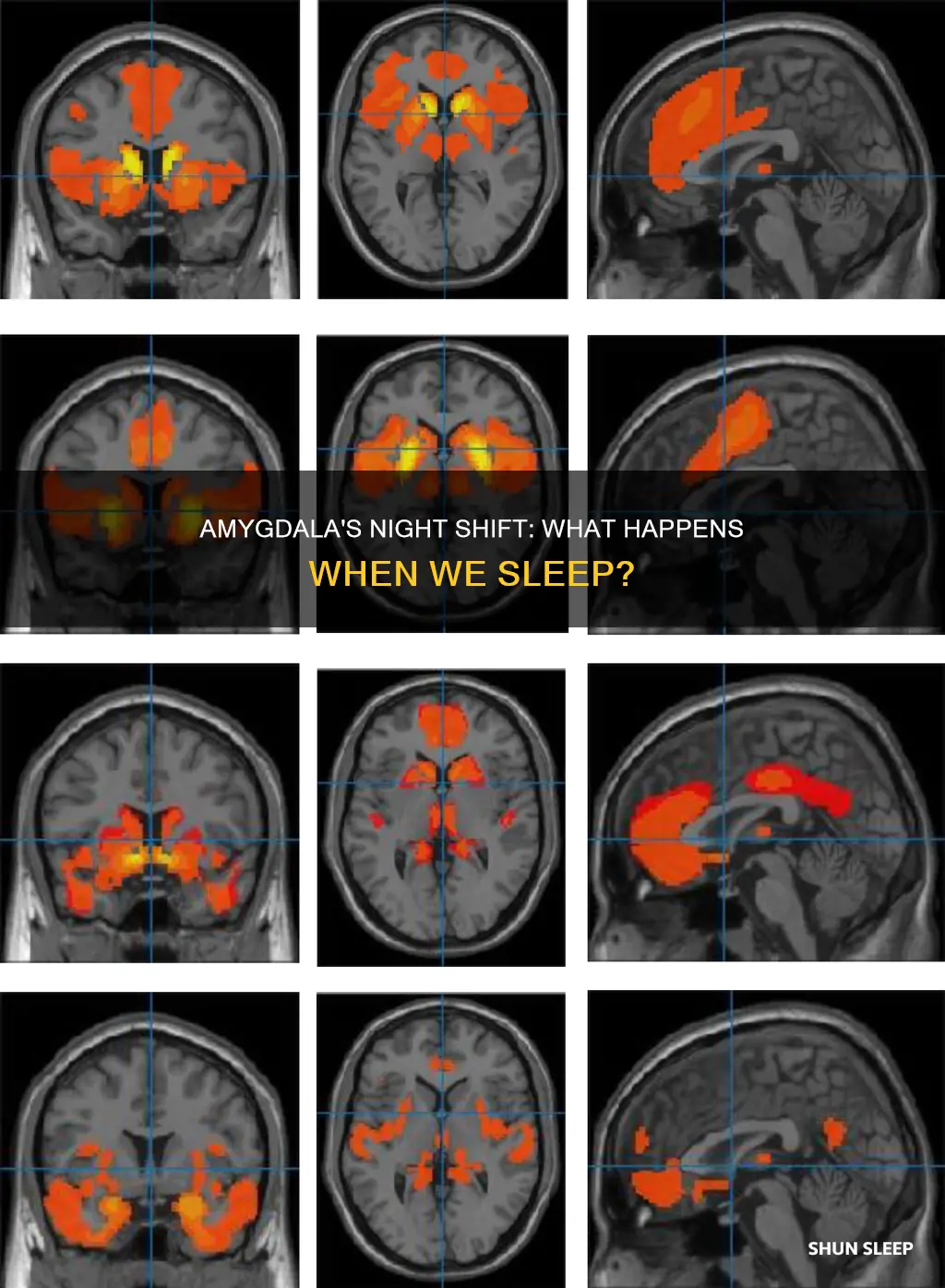 what happens to amygdala when you sleep