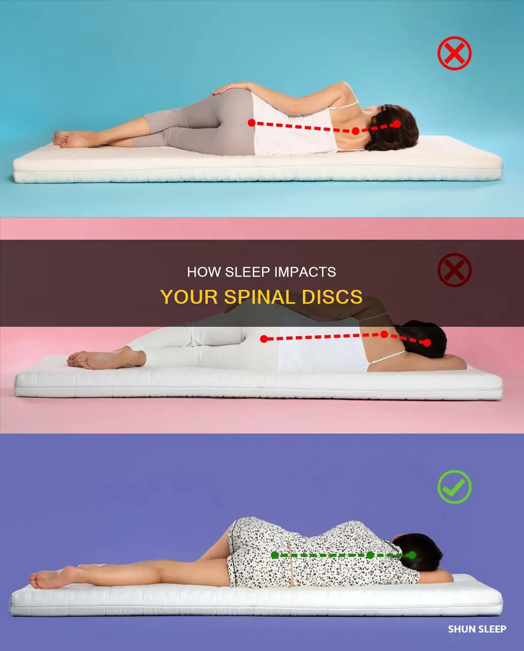 what happens to back disc while sleeping