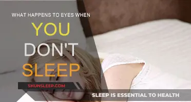 Sleep Deprivation: Eyes Suffer, Here's How