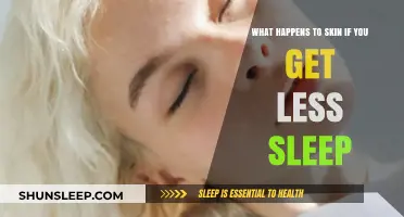 Sleep Deprivation and Skin: Effects of Less Sleep on Your Complexion