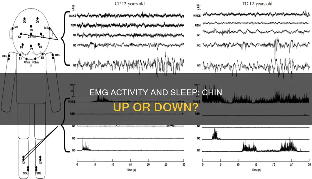 what happens to the chin emg at sleep onset