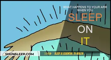 Arm Numbness: What Happens When You Sleep on It?