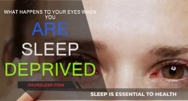 Sleep Deprivation: Its Impact on Your Eyes