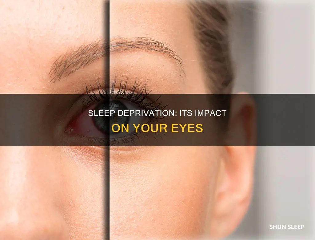 what happens to your eyes when you are sleep deprived