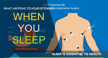 Exploring Sleep's Impact on Your Stomach Health