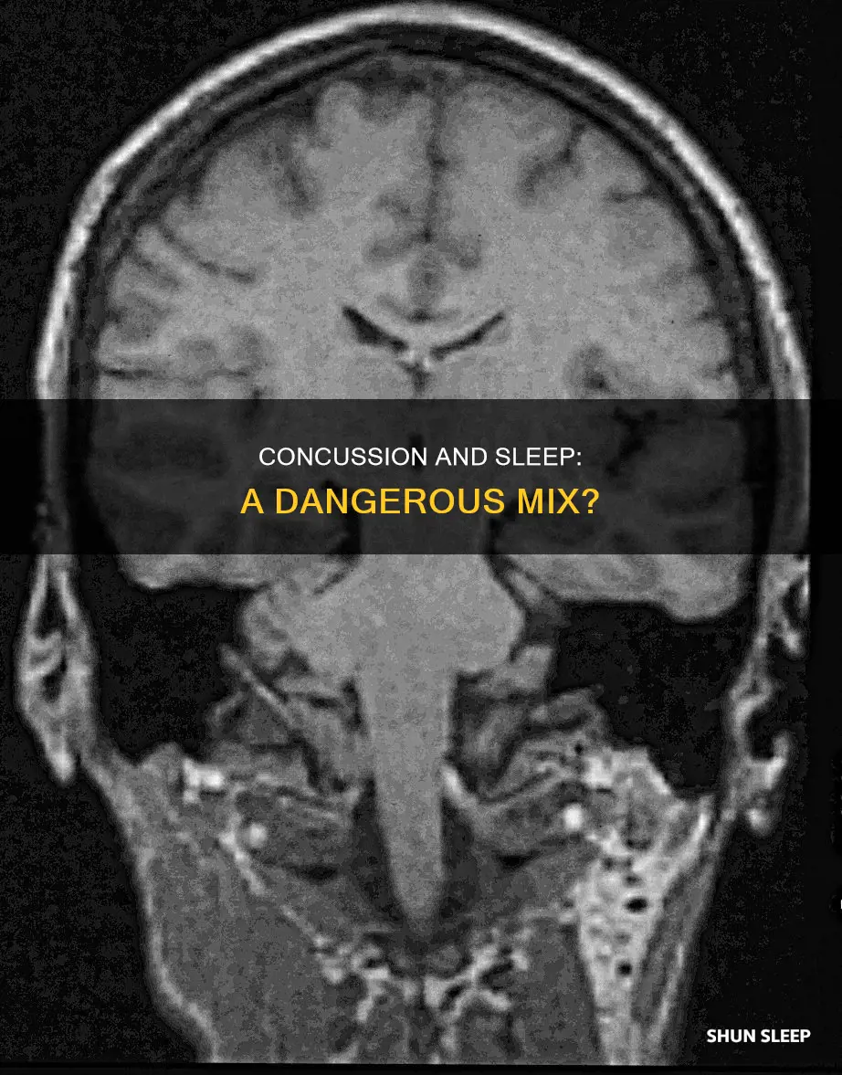 what happens when a person with concussion sleep