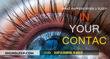 A Dangerous Habit: Sleeping with Contacts