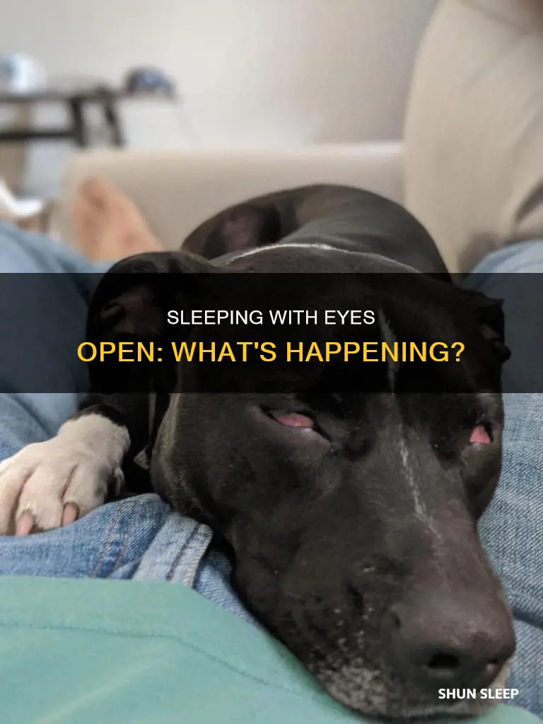 what happens when u sleep with your eyes open