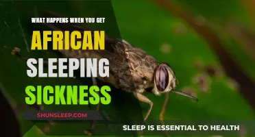 African Sleeping Sickness: Symptoms, Progression, and Urgent Treatment Needs