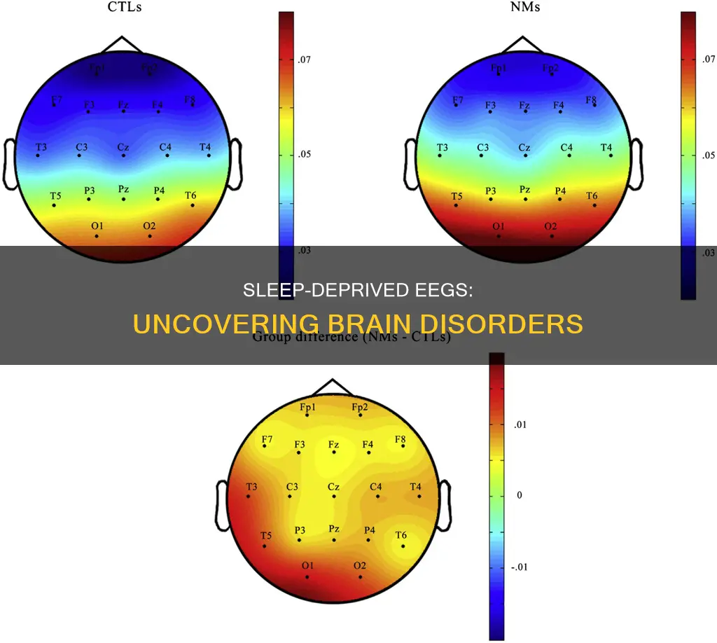 what is a sleep deprived eeg used for