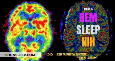 Understanding REM Sleep: The NIH Perspective