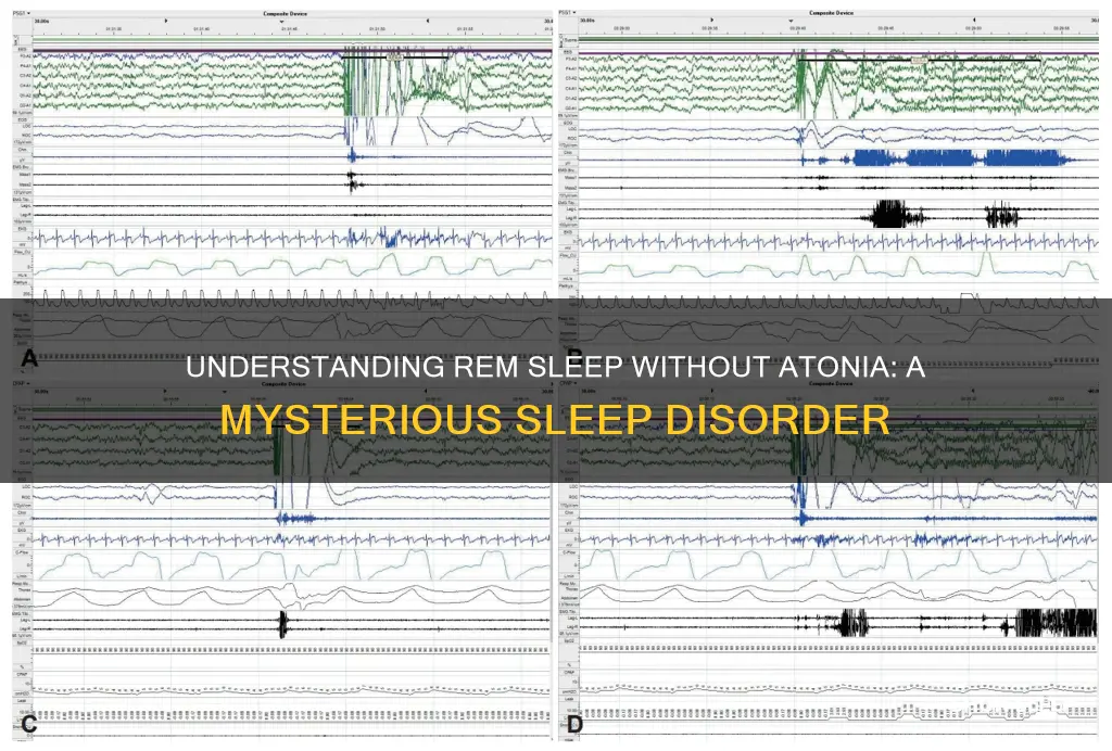 what is rem sleep without atonia
