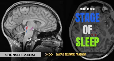 REM Sleep: The Intriguing Stage of Our Sleep Cycle