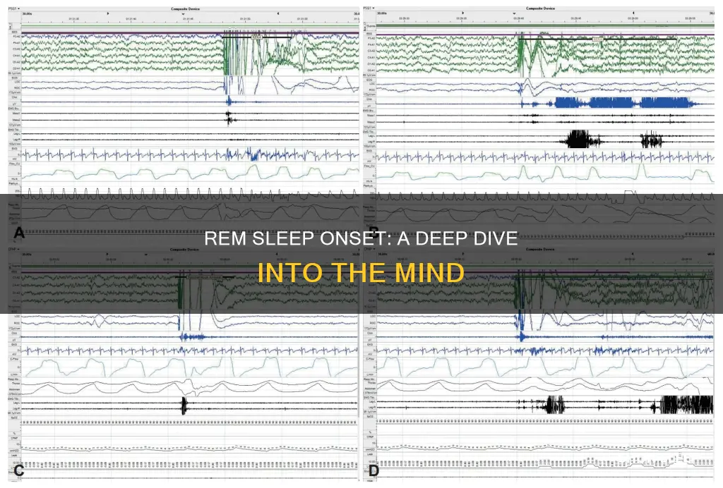 what is sleep onset rem periods