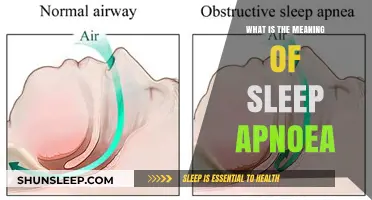 Understanding Sleep Apnea: Causes, Symptoms, and Treatment