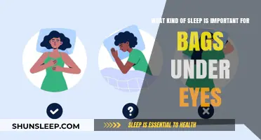 Understanding Sleep: Banishing Under-Eye Bags
