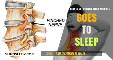 Why Your Leg Falls Asleep: Pinched Nerves and Common Causes