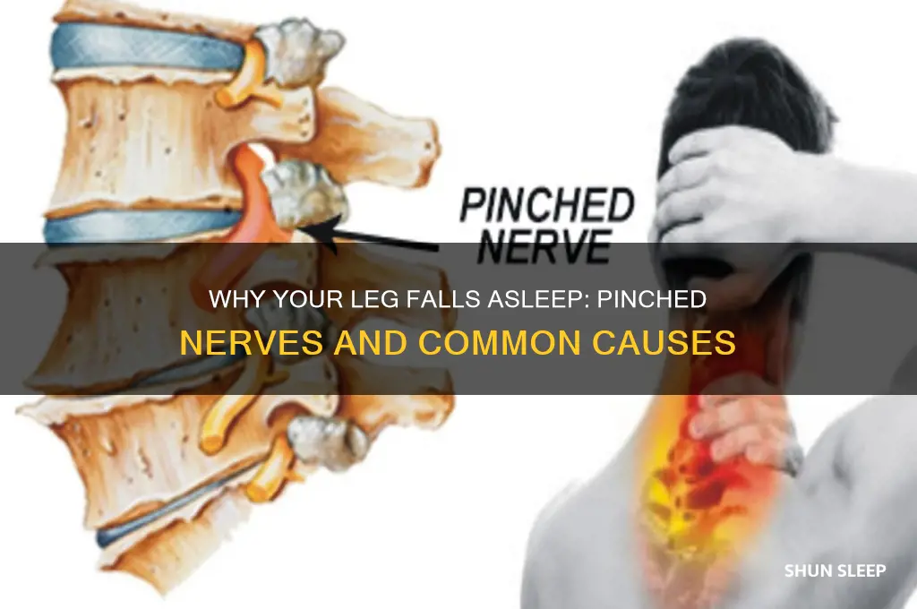 what nerves get pinched when your leg goes to sleep